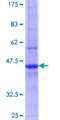 TCAP / Telethonin Protein - 12.5% SDS-PAGE Stained with Coomassie Blue.
