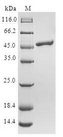 TCAP / Telethonin Protein - (Tris-Glycine gel) Discontinuous SDS-PAGE (reduced) with 5% enrichment gel and 15% separation gel.