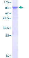 TCBE / KCS / HRD Protein - 12.5% SDS-PAGE of human TBCE stained with Coomassie Blue