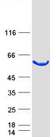 TCBE / KCS / HRD Protein - Purified recombinant protein TBCE was analyzed by SDS-PAGE gel and Coomassie Blue Staining
