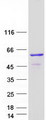 TCBE / KCS / HRD Protein - Purified recombinant protein TBCE was analyzed by SDS-PAGE gel and Coomassie Blue Staining