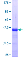 TCEA1 / TFIIS Protein - 12.5% SDS-PAGE Stained with Coomassie Blue.