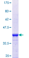 TCEA2 / TFIIS Protein - 12.5% SDS-PAGE Stained with Coomassie Blue.