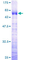 TCEA3 Protein - 12.5% SDS-PAGE of human TCEA3 stained with Coomassie Blue