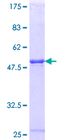 TCEAL1 Protein - 12.5% SDS-PAGE Stained with Coomassie Blue.
