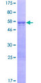 TCEAL2 Protein - 12.5% SDS-PAGE of human TCEAL2 stained with Coomassie Blue