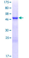 TCEAL3 Protein - 12.5% SDS-PAGE of human TCEAL3 stained with Coomassie Blue