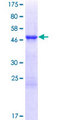 TCEAL3 Protein - 12.5% SDS-PAGE of human TCEAL3 stained with Coomassie Blue