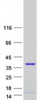 TCEAL3 Protein - Purified recombinant protein TCEAL3 was analyzed by SDS-PAGE gel and Coomassie Blue Staining