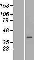 TCEAL4 Protein - Western validation with an anti-DDK antibody * L: Control HEK293 lysate R: Over-expression lysate