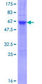 TCEAL4 Protein - 12.5% SDS-PAGE of human TCEAL4 stained with Coomassie Blue