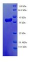 TCEB1 / Elongin C Protein