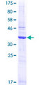 TCEB1 / Elongin C Protein - 12.5% SDS-PAGE of human TCEB1 stained with Coomassie Blue