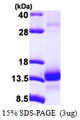 TCEB1 / Elongin C Protein