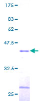 TCEB2 / Elongin B Protein - 12.5% SDS-PAGE of human TCEB2 stained with Coomassie Blue