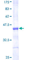 TCF12 / HEB Protein - 12.5% SDS-PAGE Stained with Coomassie Blue.