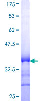 TCF19 / TCF-19 Protein - 12.5% SDS-PAGE Stained with Coomassie Blue