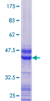TCF21 / Epicardin Protein - 12.5% SDS-PAGE of human TCF21 stained with Coomassie Blue