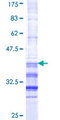 TCF21 / Epicardin Protein - 12.5% SDS-PAGE Stained with Coomassie Blue