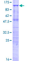 TCF25 Protein - 12.5% SDS-PAGE of human TCF25 stained with Coomassie Blue