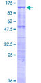 TCF25 Protein - 12.5% SDS-PAGE of human TCF25 stained with Coomassie Blue