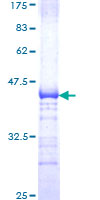 TCF3 / E2A Protein - 12.5% SDS-PAGE Stained with Coomassie Blue.