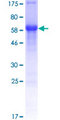 TCF4 Protein - 12.5% SDS-PAGE of human TCF4 stained with Coomassie Blue