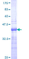 TCF7 Protein - 12.5% SDS-PAGE Stained with Coomassie Blue.