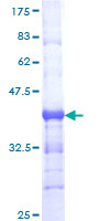 TCF7L1 / TCF-3 Protein - 12.5% SDS-PAGE Stained with Coomassie Blue.