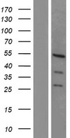 TCF7L2 / TCG4 Protein - Western validation with an anti-DDK antibody * L: Control HEK293 lysate R: Over-expression lysate