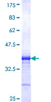 TCFL5 Protein - 12.5% SDS-PAGE Stained with Coomassie Blue.
