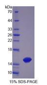 TCHH / Trichohyalin Protein - Recombinant  Trichohyalin By SDS-PAGE