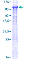 TCHHL1 Protein - 12.5% SDS-PAGE of human TCHHL1 stained with Coomassie Blue