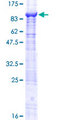 TCHHL1 Protein - 12.5% SDS-PAGE of human TCHHL1 stained with Coomassie Blue