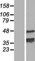 TCHP Protein - Western validation with an anti-DDK antibody * L: Control HEK293 lysate R: Over-expression lysate