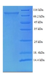 TCHP Protein