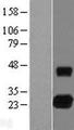 TCL / RHOJ Protein - Western validation with an anti-DDK antibody * L: Control HEK293 lysate R: Over-expression lysate