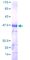 TCL / RHOJ Protein - 12.5% SDS-PAGE of human RHOJ stained with Coomassie Blue