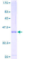 TCL1B Protein - 12.5% SDS-PAGE of human TCL1B stained with Coomassie Blue