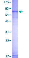 TCN1 Protein - 12.5% SDS-PAGE of human TCN1 stained with Coomassie Blue