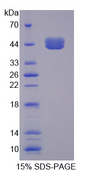 TCN1 Protein - Recombinant Transcobalamin I By SDS-PAGE