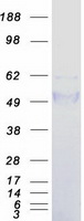 TCN1 Protein - Purified recombinant protein TCN1 was analyzed by SDS-PAGE gel and Coomassie Blue Staining