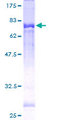 TCN2 Protein - 12.5% SDS-PAGE of human TCN2 stained with Coomassie Blue