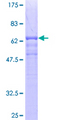 TCN2 Protein - 12.5% SDS-PAGE of human TCN2 stained with Coomassie Blue