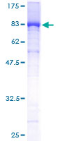 TCP1 Protein - 12.5% SDS-PAGE of human TCP1 stained with Coomassie Blue