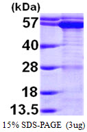 TCP1 Protein