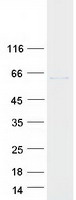 TCP1 Protein - Purified recombinant protein TCP1 was analyzed by SDS-PAGE gel and Coomassie Blue Staining