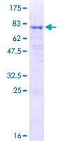 TCP10 Protein - 12.5% SDS-PAGE of human TCP10 stained with Coomassie Blue