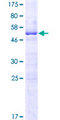 TCP10L Protein - 12.5% SDS-PAGE of human TCP10L stained with Coomassie Blue
