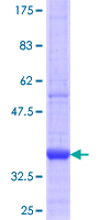 TCP11 Protein - 12.5% SDS-PAGE Stained with Coomassie Blue.